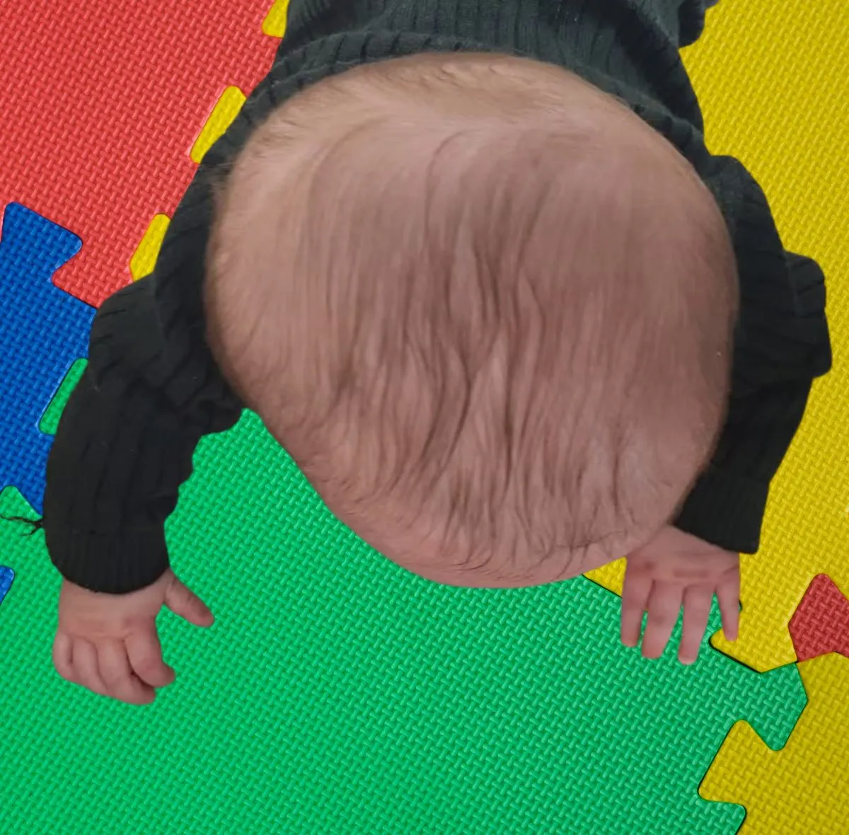 מבט מלמעלה על ראש של תינוק ששוכב על הבטן על משטח משחק, המדגים אסימטריה בצורת הראש